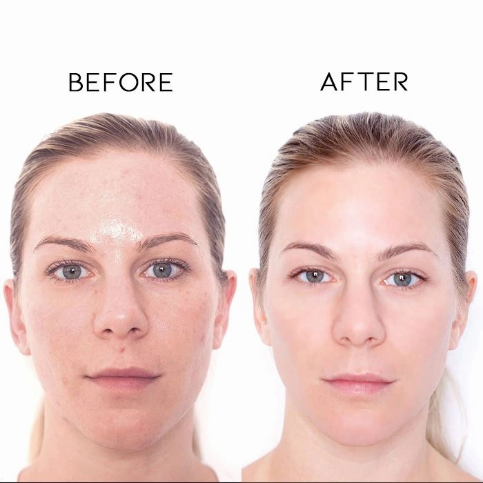 10% Niacinamide Brightening Serum