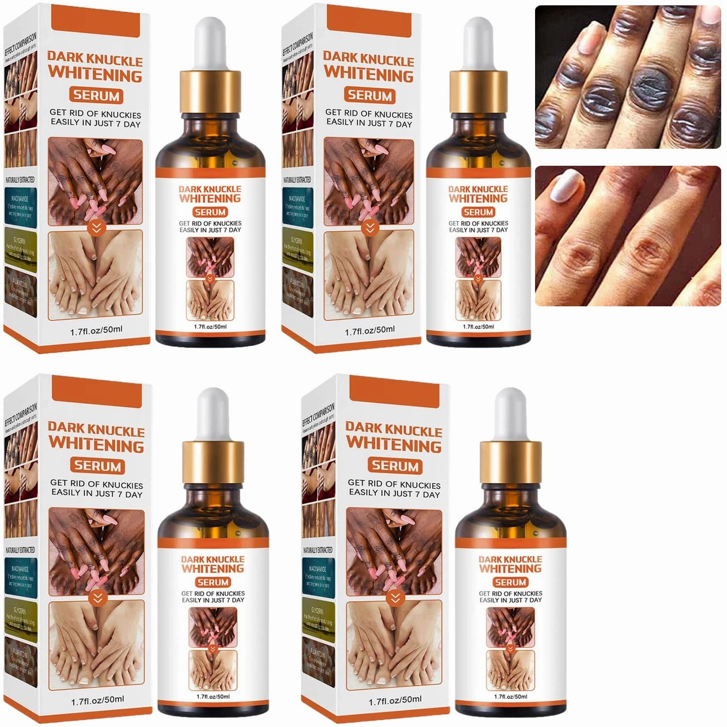 Acanthosis Nigricans Oil Dark Spot Corrector, Dark Spot Lighten Body Black Skin, Skin Brightening Serum, for Finger Elbow and Knee (4Pcs)