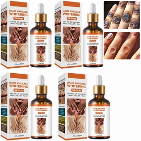 Acanthosis Nigricans Oil Dark Spot Corrector, Dark Spot Lighten Body Black Skin, Skin Brightening Serum, for Finger Elbow and Knee (4Pcs)