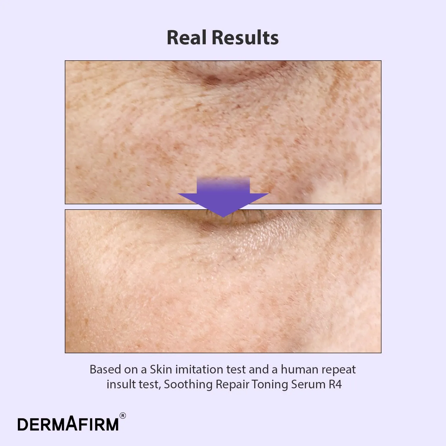 DERMAFIRM Soothing Repair Toning Serum R4 | Korean Bakuchiol Face Serum w/Niacinamide & Peptides | Calming and Correcting Facial Serum | No Animal Trials No Parabens 1.01 fl oz