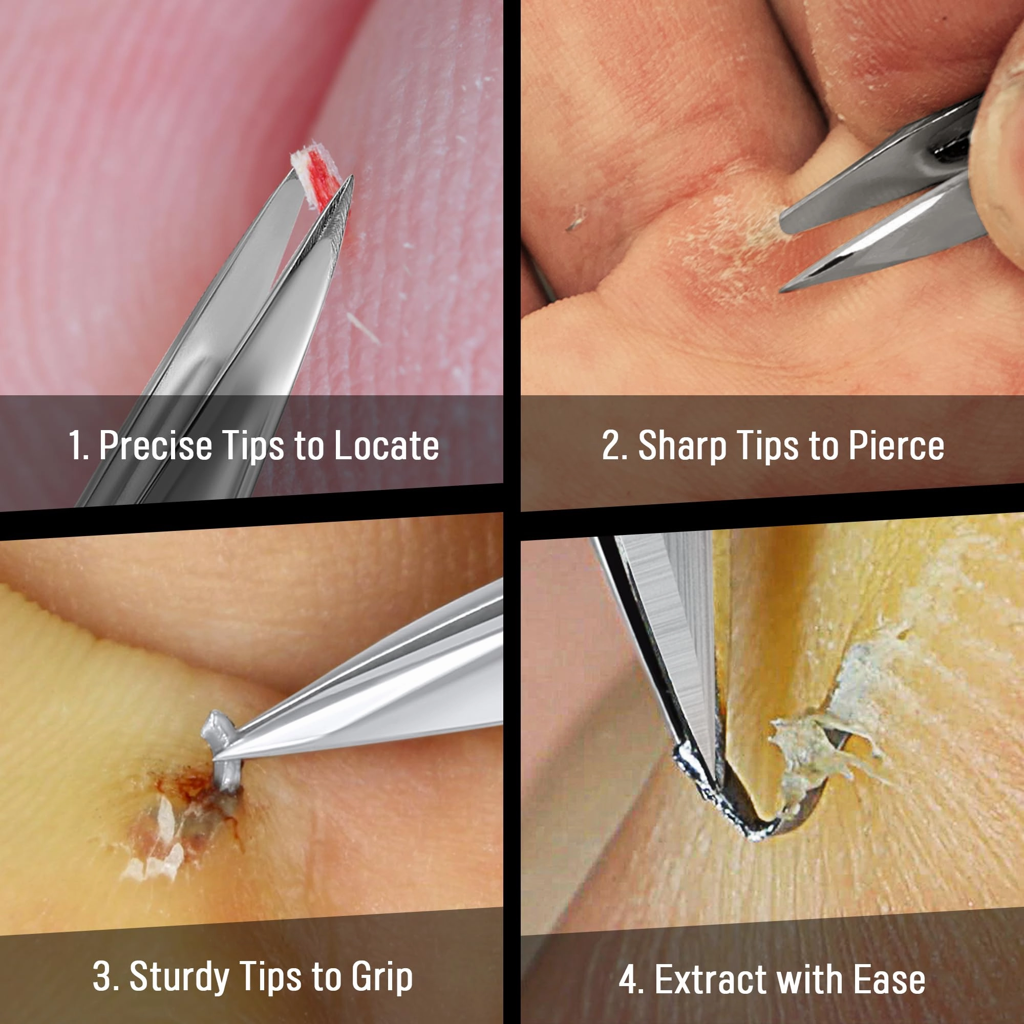 DUROX Splinter Tweezers for Splinter Removal – Sharp Pointy Tip to Extract Wood, Metal, Cactus Splinters – Foldable EDC Keychain Tool, First Aid Sliver Remover, Sliver Gripper Tweezers