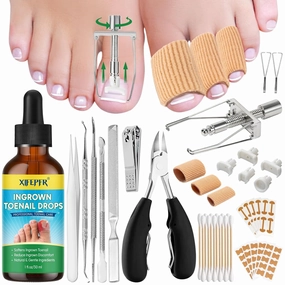 Ingrown Toenail Tools Kit, Ingrown Toenail Treatment, Stainless Steel Ingrown Toenail Removal Kit, Ingrown Toenail Corrector, Corrector Patch, Toenail Clipper, Nail File Lifter Pedicure Tool