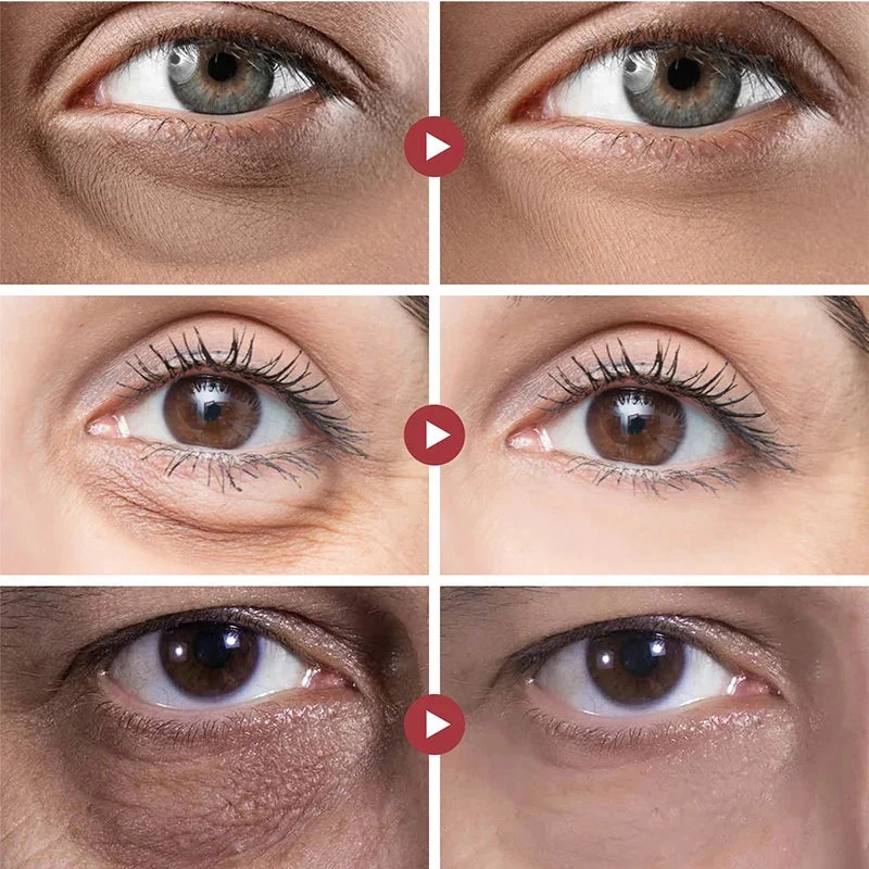 InstaLift™ Anti-Wrinkle Eye Cream