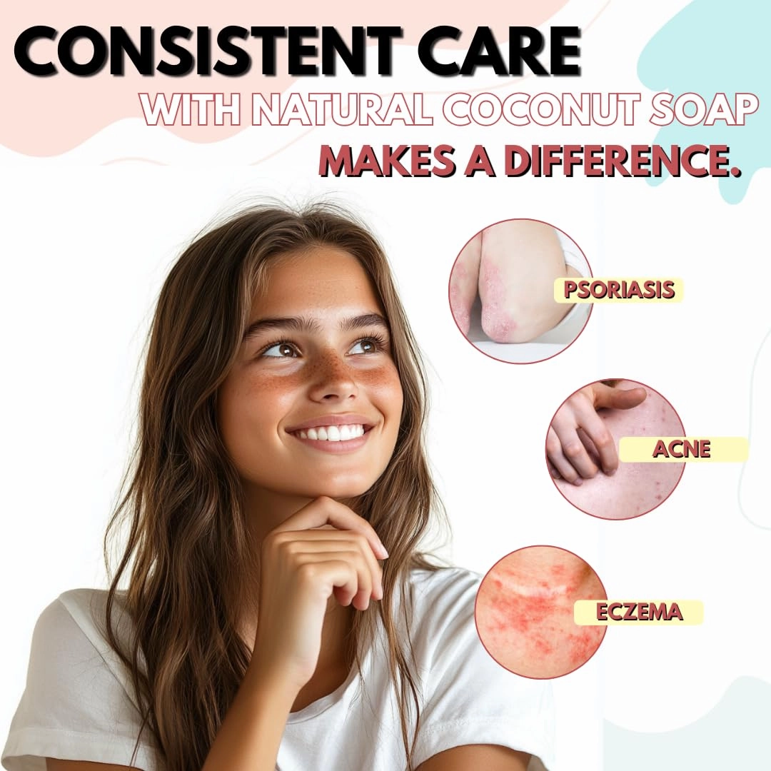 Lather Kids Soap Bar Body Wash and Apply to Sensitive Skin – Hypoallergenic and Gentle, Soothing Dryness, Eczema, and Psoriasis – Let the Natural Coconut Moisture Hydrate and Soothe. 9-Bar Pack.